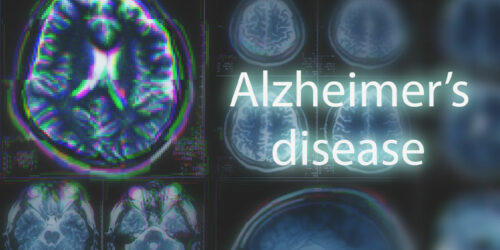 10 Early Signs of Alzheimer&#8217;s Disease