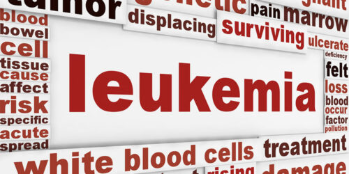 Causes and Symptoms of Leukemia