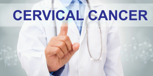 Cervical Cancer &#8211; Causes, Risk Factors, Symptoms and More