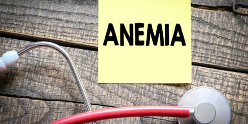 Anemia &#8211; Symptoms, Types, and More