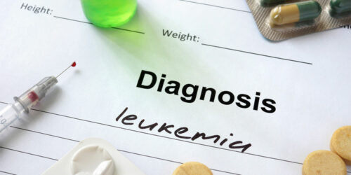 Acute Myeloid Leukemia &#8211; Stages, Types, Symptoms, Causes, and Therapies