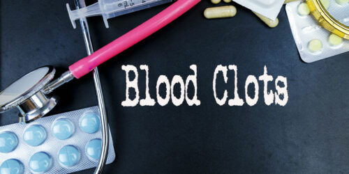 Blood Clotting Disorders &#8211; Symptoms, Causes, and More