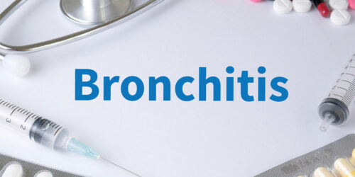 Bronchitis &#8211; Top Remedies and Management Options