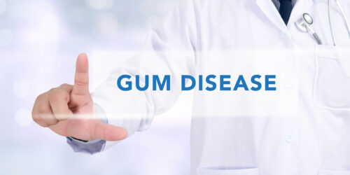 Gum Disease &#8211; Symptoms and Remedies