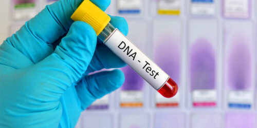 DNA Testing &#8211; Definition, Types, and Procedure