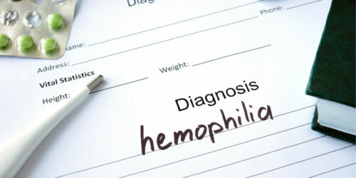 Hemophilia &#8211; Symptoms, Types, and Management Options