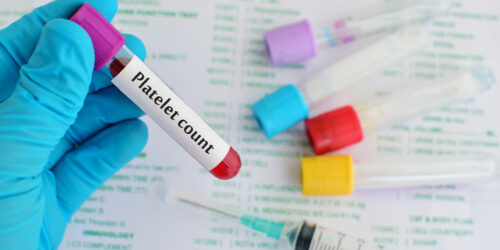 Low Platelet Count &#8211; Ways to Manage the Condition