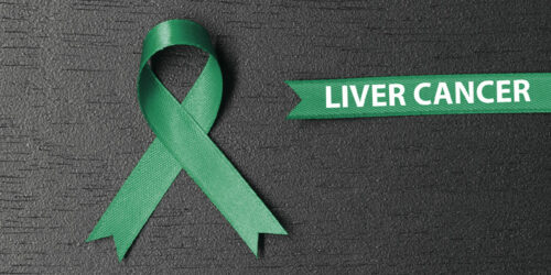 Liver Cancer &#8211; Causes, Symptoms, and Therapies