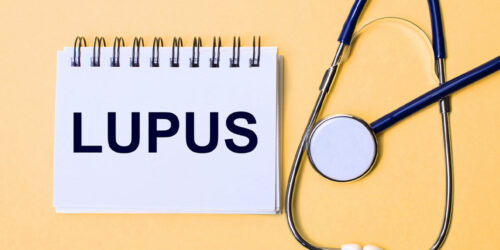 Lupus &#8211; Signs, Causes and Types