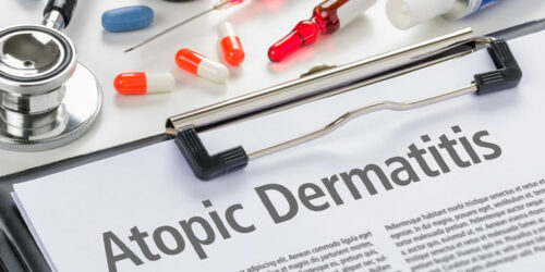 Measures to Manage and Prevent Atopic Dermatitis