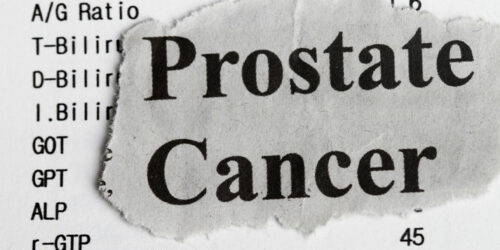 Stages, and Ways to Manage Prostate Cancer