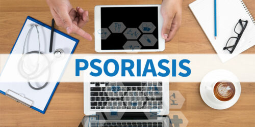 Psoriasis &#8211; Its Types and Symptoms