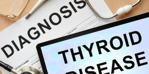 Thyroid Symptoms, Causes, Natural Remedies and Side Effects