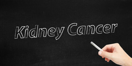 The Symptoms and Stages of Kidney Cancer