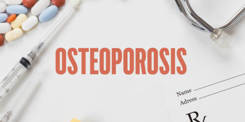 Things to Know About Osteoporosis Management