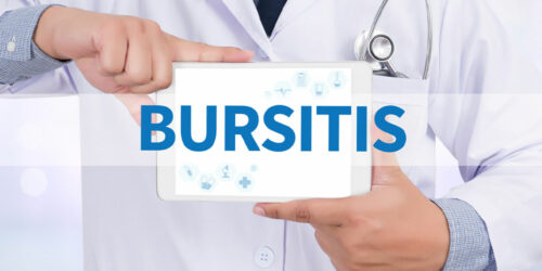 Types and Management Methods of Bursitis