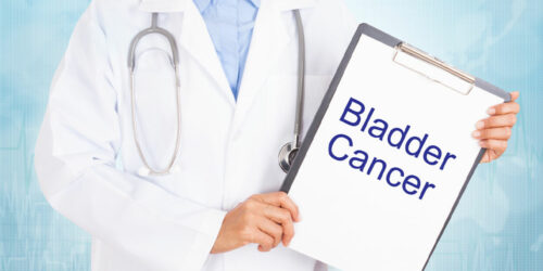 Understanding Bladder Cancer and Its Management Options