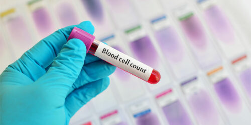 Understanding Different Aspects of Blood Cell Counts