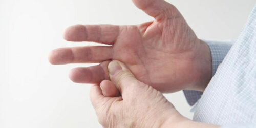 3 common causes of rheumatoid arthritis