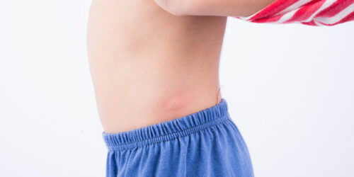 10 common types of skin rashes you should be aware of 