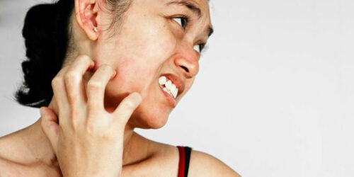 7 easy and useful ways to manage itchy skin