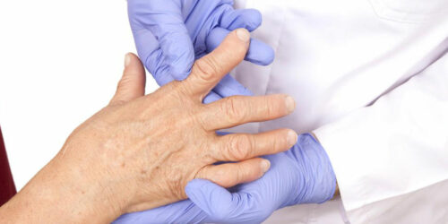 4 best remedies for rheumatoid arthritis 