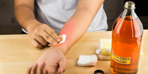 4 common treatments for itchy skin