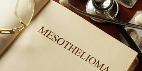 4 different types of mesothelioma you should be familiar with