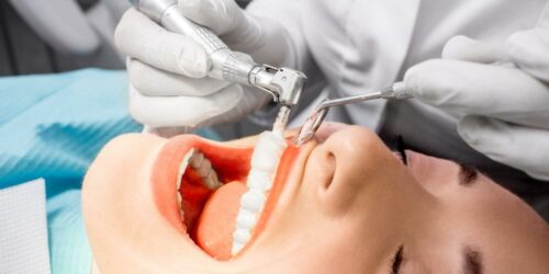 4 things you should know about good dental health