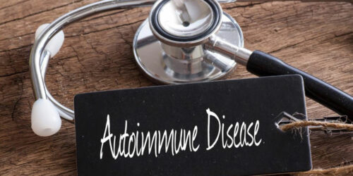 4 tips for timely diagnosis of autoimmune disease