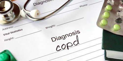 5 natural and alternative ways to treat COPD