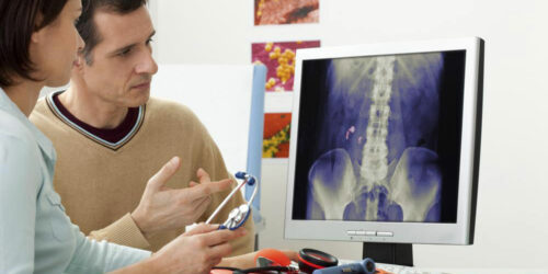 5 common FAQs regarding kidney stones