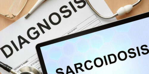 5 tell-tale signs and symptoms of sarcoidosis