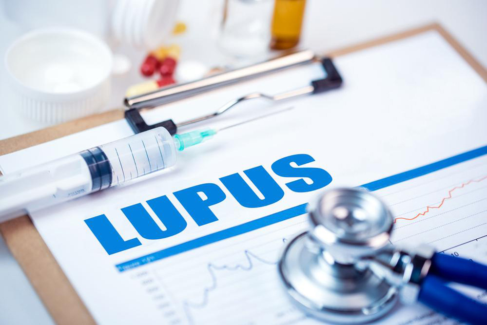 5 things to know about Lupus