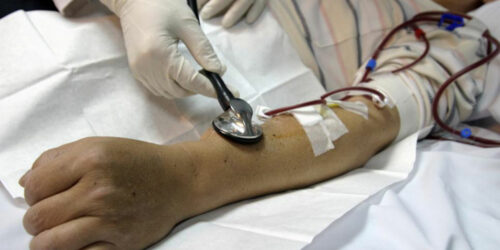 5 useful things a person undergoing kidney dialysis should know