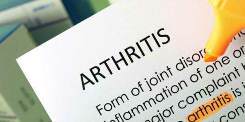 6 Effective Ways to Get Relief from Chronic Arthritis Pain Naturally