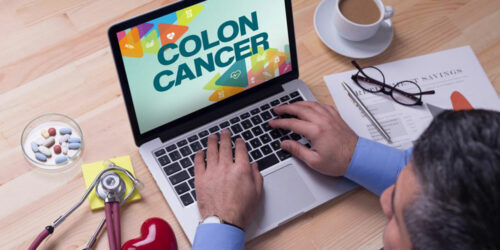 Colon Cancer: Top 3 Signs and Related Symptoms