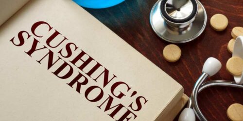 Common Signs and Symptoms of Cushing Syndrome