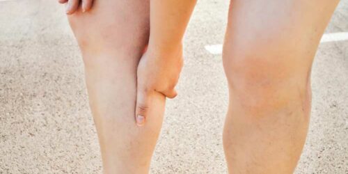 Common Symptoms of Deep Vein Thrombosis