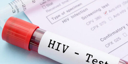 Common signs and symptoms of HIV