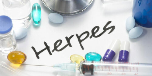 Causes and clinical symptoms of herpes