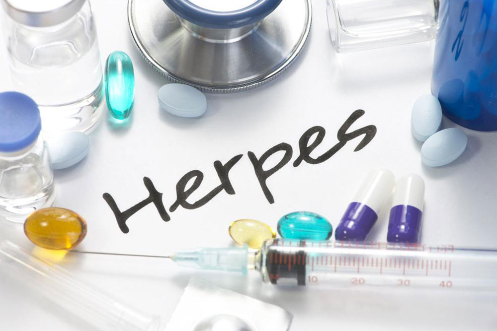 Causes and clinical symptoms of herpes