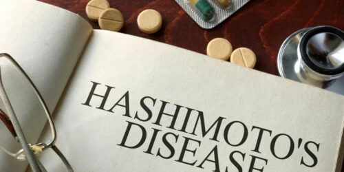 Causes and symptoms of hashimotos disease