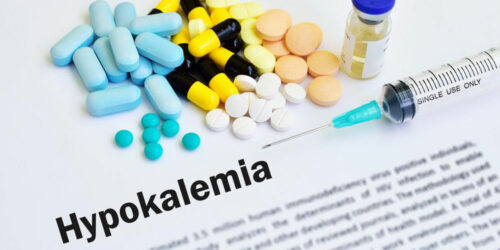 Causes and prevention of Hyperkalemia