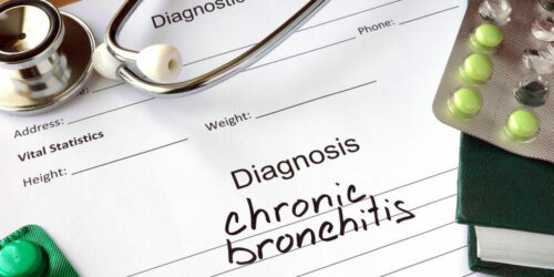 Chronic Bronchitis: An overview