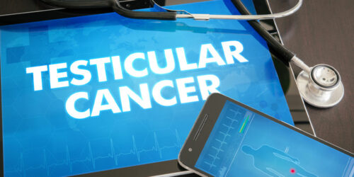 A Brief Overview of Testicular Cancer