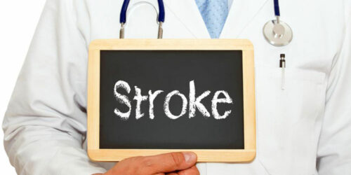 An overview of mini stroke- causes and symptoms explained