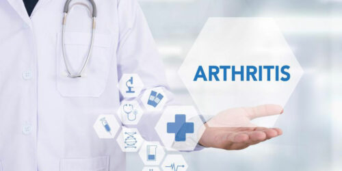 A brief overview of arthritis