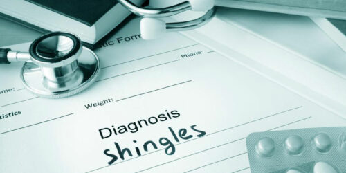 A compact guide to understanding shingles- Causes, symptoms, and treatments