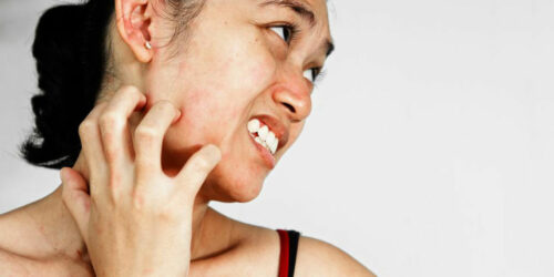 A few common types skin rash that affects people